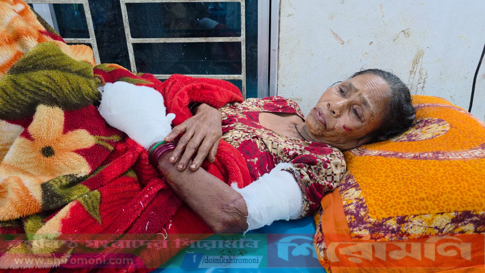 কোটালীপাড়ায় ককটেল বিস্ফোরণে এক নারী আহত