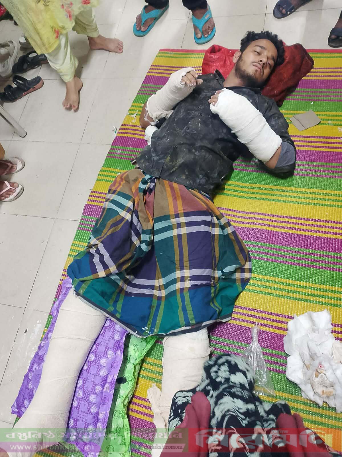 সোনারগাঁওয়ে ছাত্রদল নেতার ওপর সন্ত্রাসী হামলা, পঙ্গুতে ভর্তি