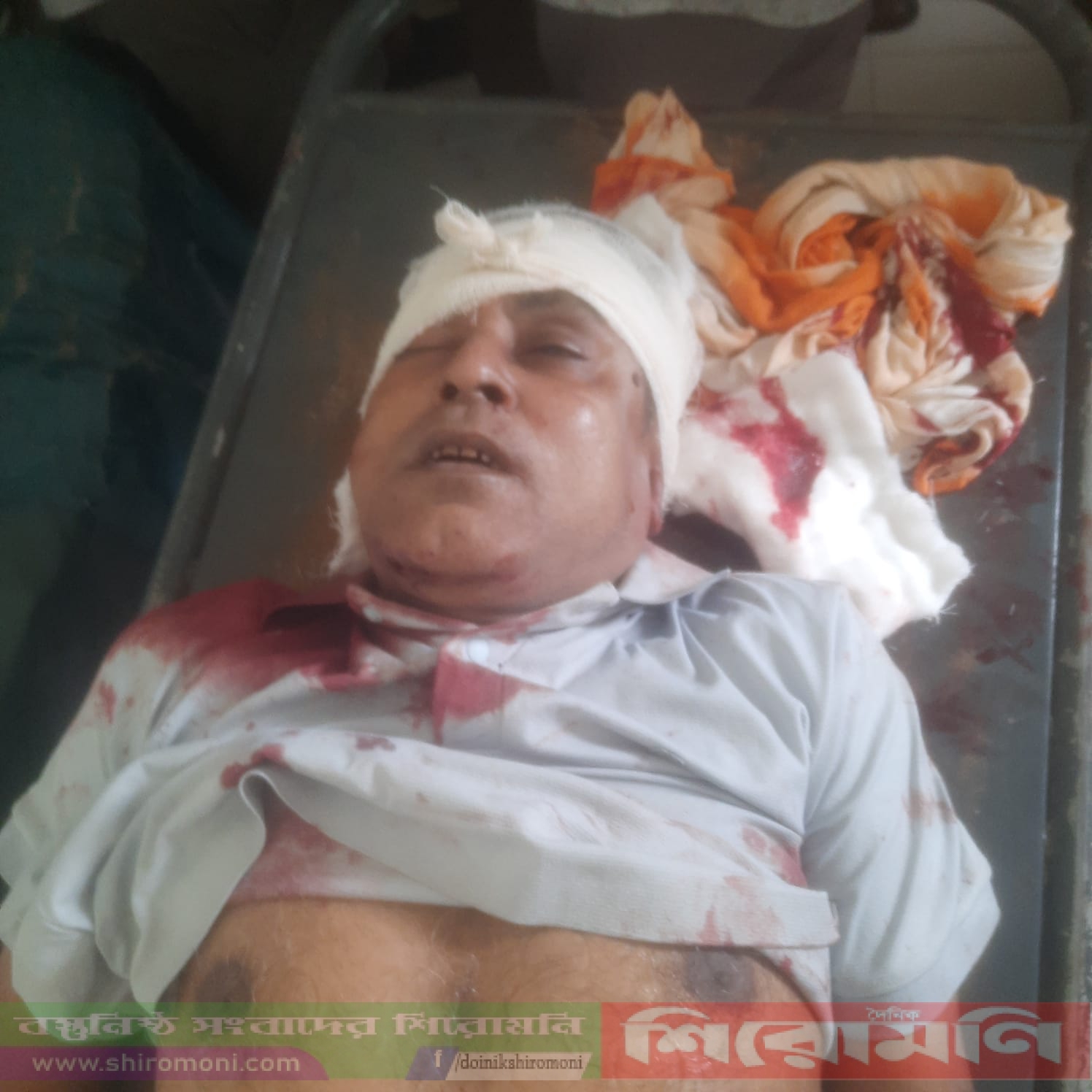 দিঘলিয়ায় চায়ের দোকানে গুলি, চিকিৎসাধীন অবস্থায় নাসিমের মৃত্যু